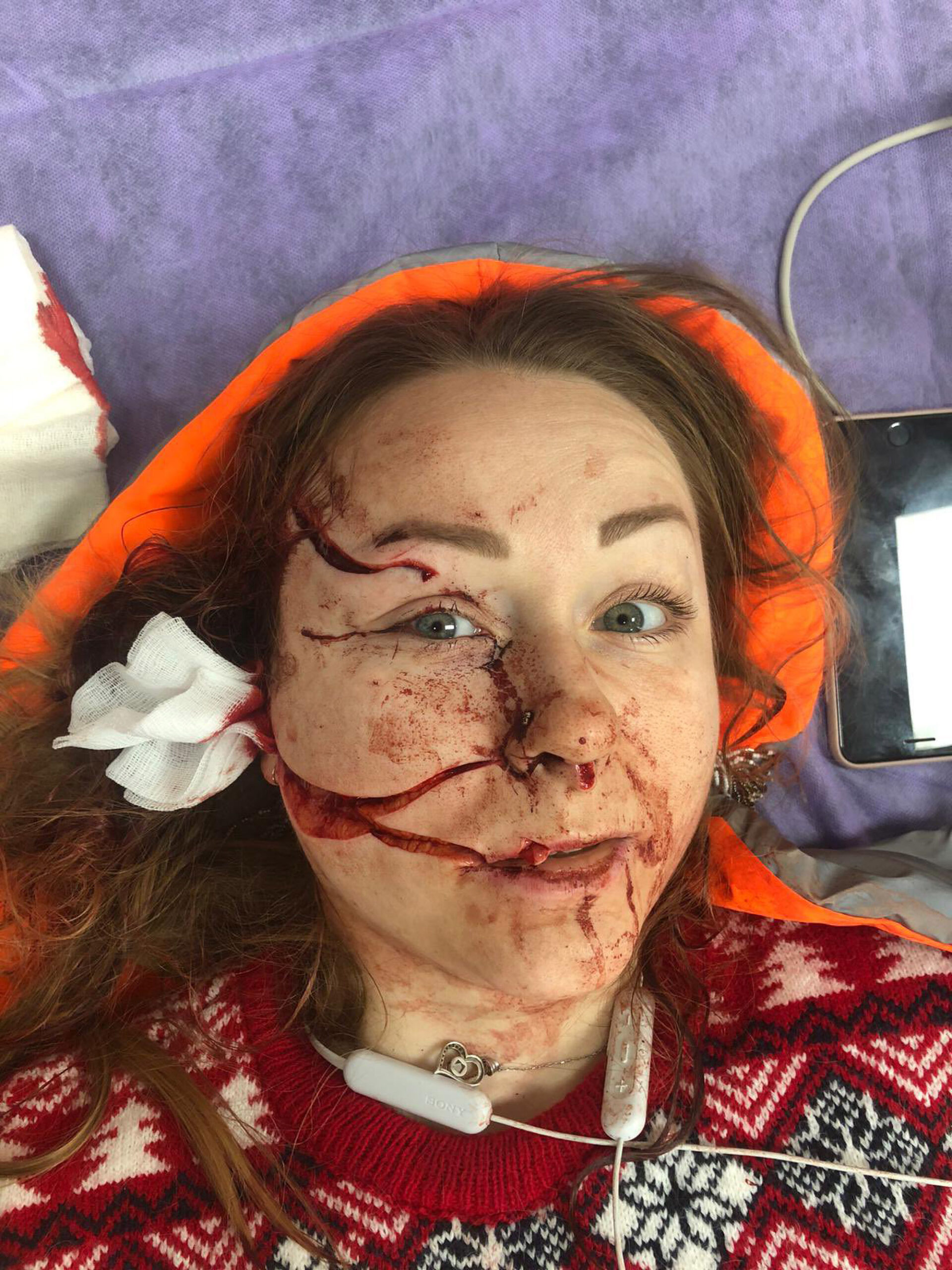 Read more about the article Woman Disfigured By Catfish Hubby Who Slashed Her Face Says She Is A New Woman Since Divorce